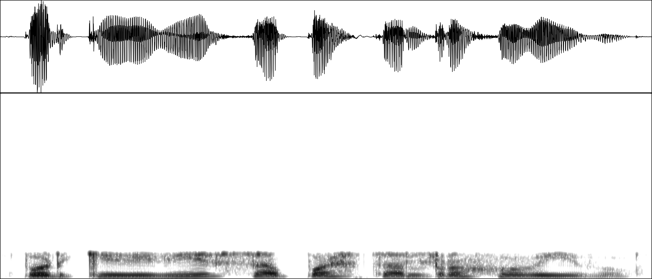 Oscilograma desde los 4000 Hz hasta los 22000 Hz)